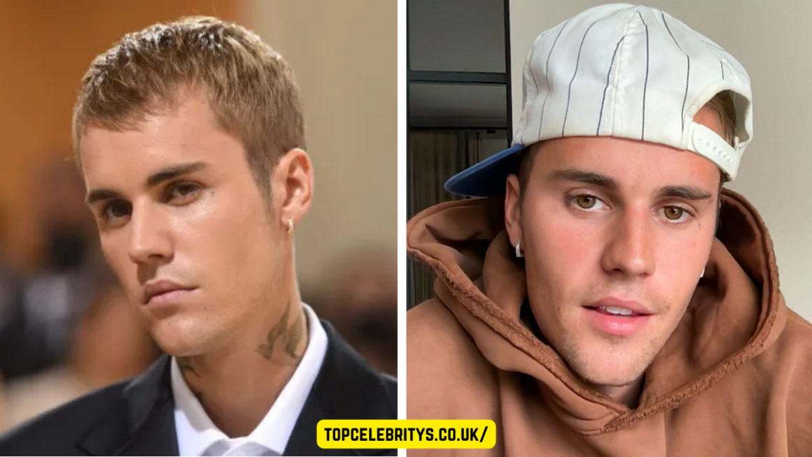 Justin Bieber Illness Explained Ramsay Hunt Syndrome Symptoms Recovery Update
